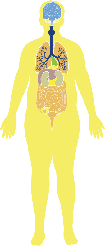 Obese Man Anatomy